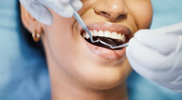 Best Emergency Wisdom Teeth Removal in Springfield, IL